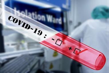 Are you covered if you test positive for COVID-19?